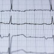 elettrocardiogramma Giornata mondiale del cuore