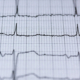elettrocardiogramma Giornata mondiale del cuore