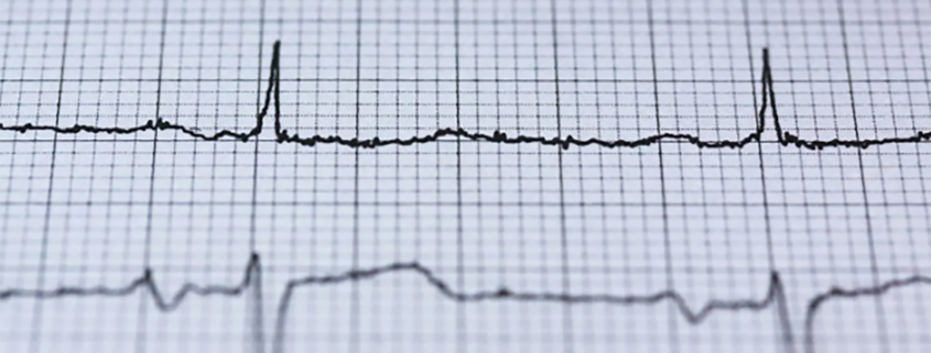 elettrocardiogramma Giornata mondiale del cuore