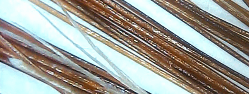 struttura capello microcamera